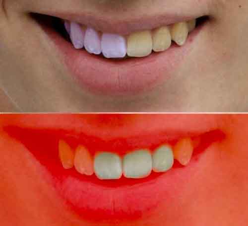 teeth photoshop whitening tutorials source yellow